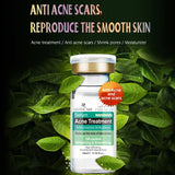 Pimple Control Face Serum Set