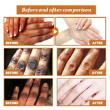 Dark Knuckle Brightening Cream