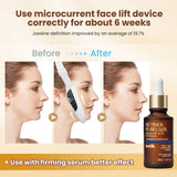 EMS V-Face Lifting Device
