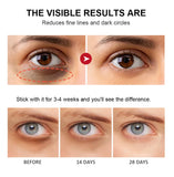 Retinol Anti-Wrinkle Eye Stick