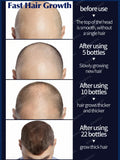 Rapid Hair Growth