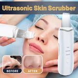 Ultrasonic Skin Scrubber