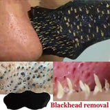Blackhead Nose Strips