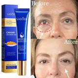 Caviar Eye Bag Removal Cream