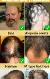 Rapid Hair Growth
