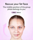 EMS 5-in-1 Facial Massager