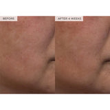 Watermelon Brightening Toner
