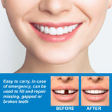 Temporary Tooth Repair Gel