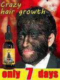 Rapid Hair Growth