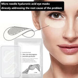 Microneedle Hyaluronic Eye Patch