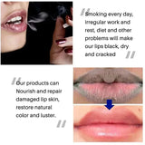 Dark Lip Lightening Balm