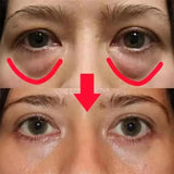 Caviar Eye Bag Removal Cream