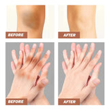 Dark Knuckle Brightening Cream