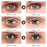 Retinol Anti-Dark Circle Eye Serum