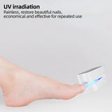 Nail Fungus Laser Fix
