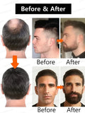 BeardBoost Serum