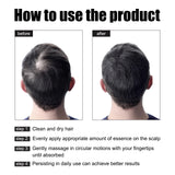 Vitamin E Hair Growth Oil