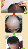 Rapid Hair Growth