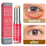 Retinol Anti-Wrinkle Eye Cream