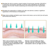 ZGTS 192-Needle Derma Roller