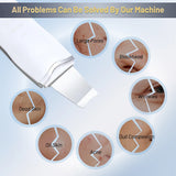Ultrasonic Skin Scrubber