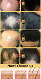 Rapid Hair Growth