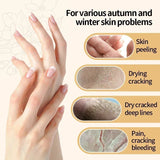 Kojic Acid Hand Cream