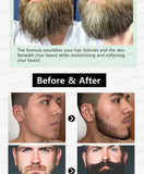 Beard Growth Essence