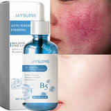 Anti-Redness Repair Serum