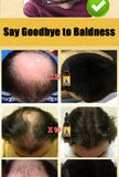 Rapid Hair Growth