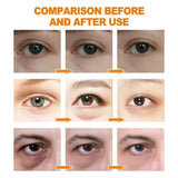 Retinol Anti-Dark Circle Eye Serum