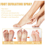 Ouhoe Foot Exfoliating Spray