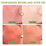 SPF50+ Facial Sunscreen Cream