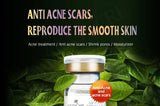 Pimple Control Face Serum Set