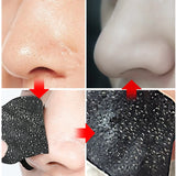 Blackhead Nose Strips