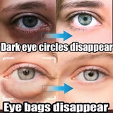 Caviar Eye Bag Removal Cream