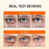 Retinol Anti-Dark Circle Eye Serum