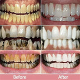 5D Whitening Toothpaste