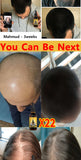 Rapid Hair Growth