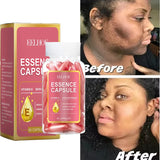 Vitamin E Dark Spot Capsule