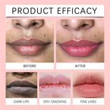 Dark Lip Lightening Balm