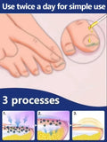 Fast Nail Fungus Repair