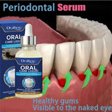 Gum Repair Gel Serum