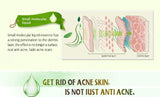 Pimple Control Face Serum Set