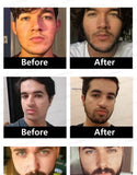 BeardBoost Serum