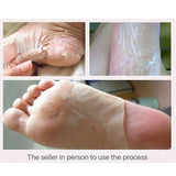 RenewPeel Foot Mask