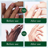 Dark Knuckle Brightening Cream