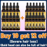Rapid Hair Growth