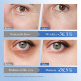 Caviar Eye Bag Removal Cream