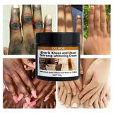 Dark Knuckle Brightening Cream